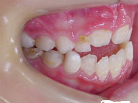 041127 teeth side_copy.jpg