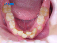070907　lower teeth_copy.jpg