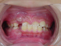 091015whole teeth_copy.jpg