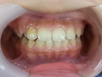 110421　whole teeth_copy.jpg