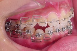 180827-2.jpgのサムネール画像