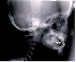 20180914-3.pngのサムネール画像