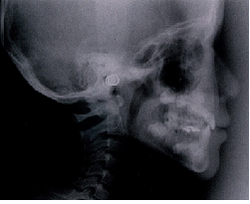 20180914-4.pngのサムネール画像