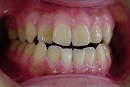s-011002 whole teeth.jpg