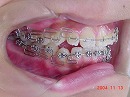 s-031113 teeth side.jpg