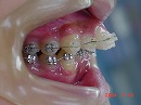 s-040515 right side teeth ②.jpg