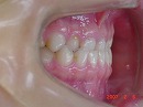 s-070206　teeth side.jpg