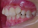 s-070830　teeth side2 cut.jpg