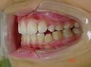 s-080104　teeth side2.jpg