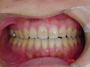 s-080121　whole teeth.jpg