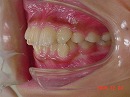 s-081220　　teeth side2.jpg