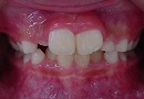 s-090126whole teeth cut.jpg