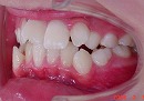 s-090305　teeth side2 cut.jpg