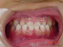 s-090522　whole teeth.jpg