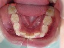s-090602lower teeth.jpg