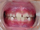 s-090602whole teeth.jpg
