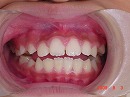 s-090803　whole teeth.jpg
