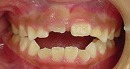 s-090806　whole teeth cut.jpg