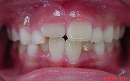 s-091006　whole teeth cut.jpg