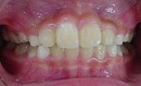 s-100227　whole teeth cut.jpg