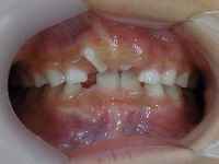 s-100614　whole teeth cut_copy.jpg