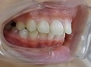 s-100705　teeth side.jpg