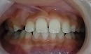 s-100709　whole teeth cut.jpg