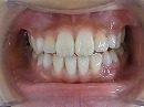 s-100722　whole teeth.jpg