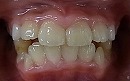 s-100904　whole teeth.jpg