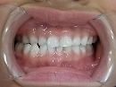 s-101104　whole teeth.jpg