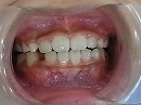 s-101111　whole teeth.jpg