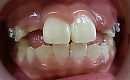s-110208　whole teeth cut.jpg