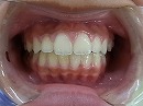 s-110208　whole teeth.jpg