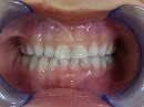 s-110421　whole teeth.jpg
