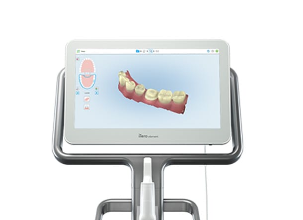 術前シミュレーション